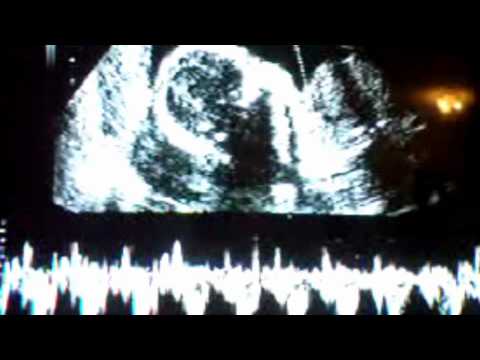 Do the Unborn Have Rights?